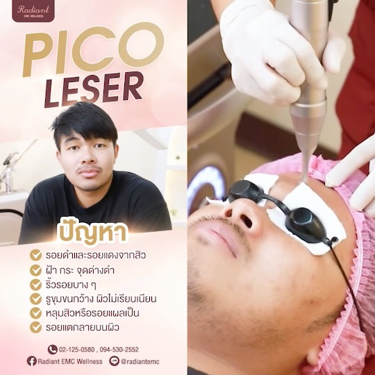 PICO LASER เหมาะสำหรับใคร