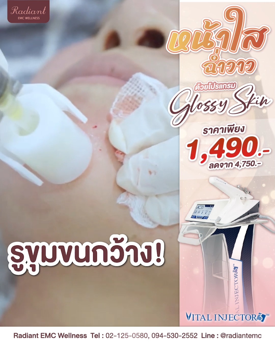 โปรแกรม 𝐆𝐥𝐨𝐬𝐬𝐲 𝐒𝐤𝐢𝐧 หน้าใส ฉ่ำวาว แบบสาวเกาหลี