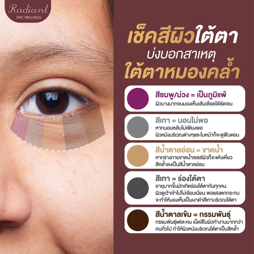 เช็คสีผิวใต้ตา