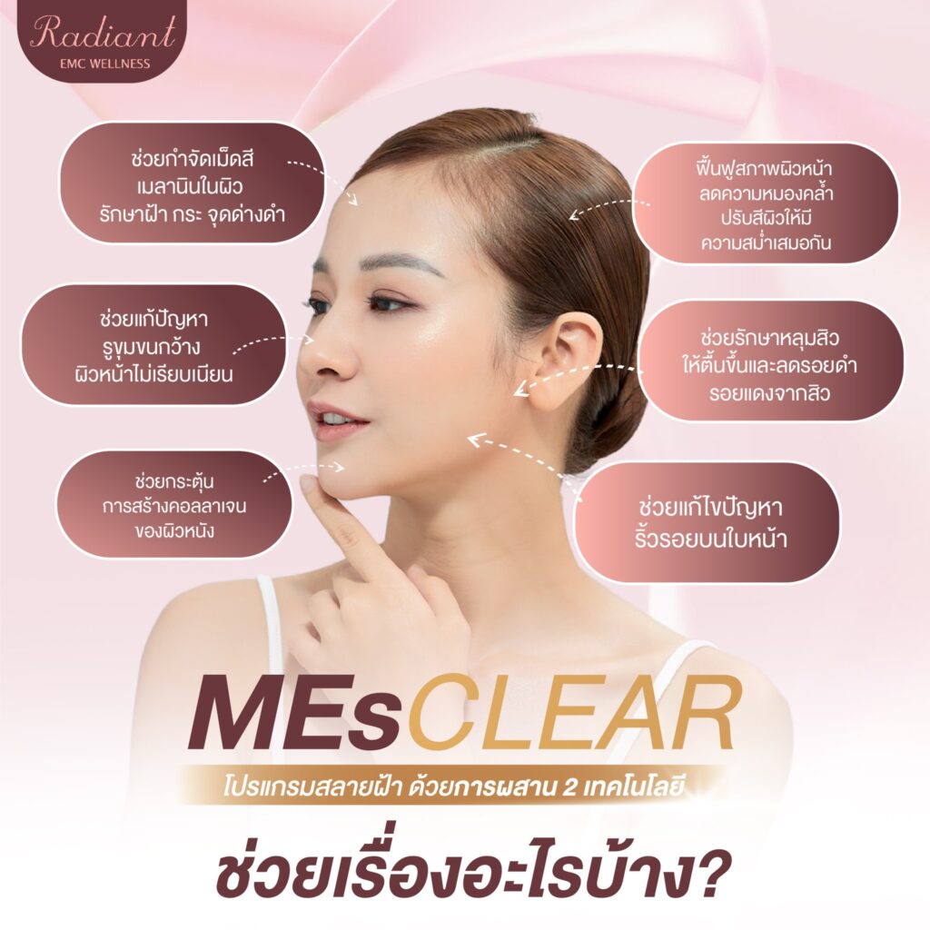 สลายฝ้า