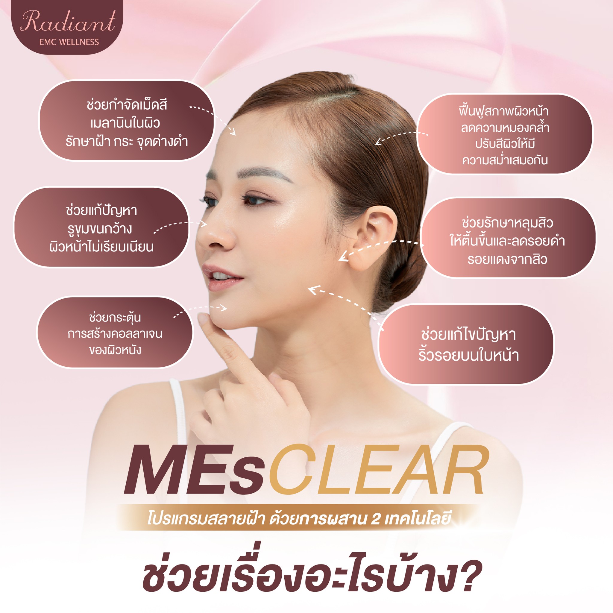 สลายฝ้า