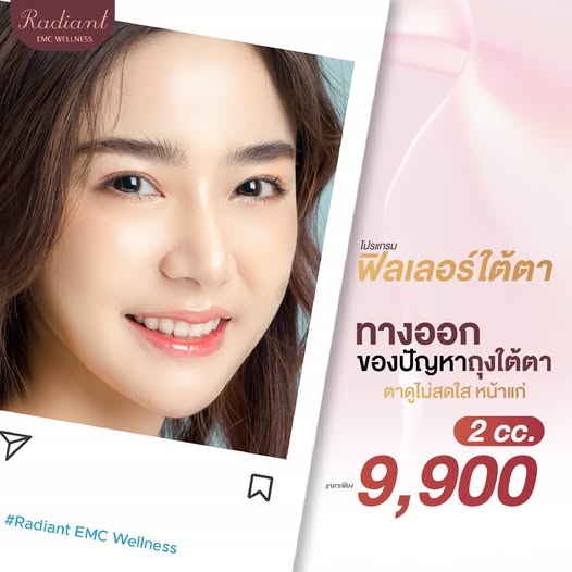 ฟิลเลอร์ใต้ตา