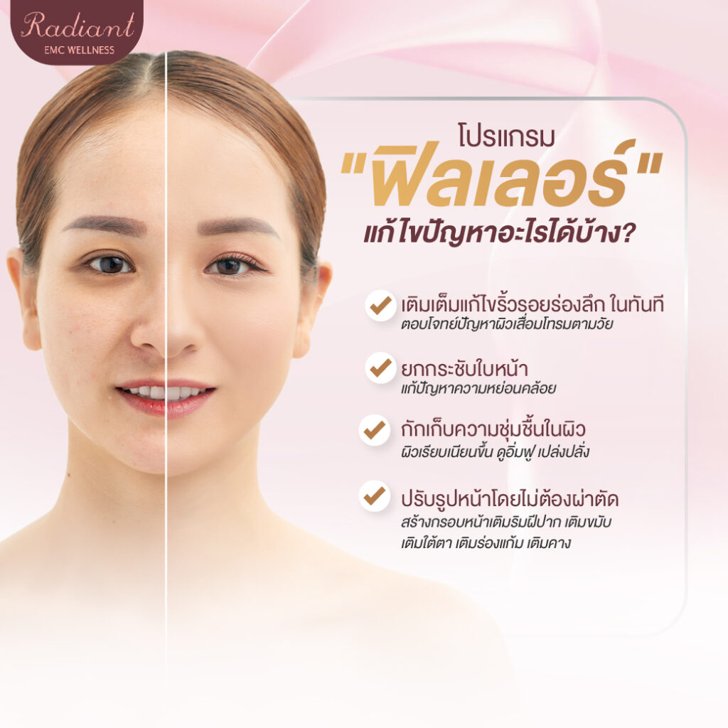 โปรแกรมฟิลเลอร์